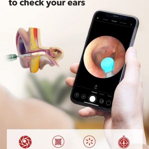 BEBIRDPRO M9 Smart Visual Ear Removal Tool Safely HD 8MP Camera for iOS, Android Smart Phones