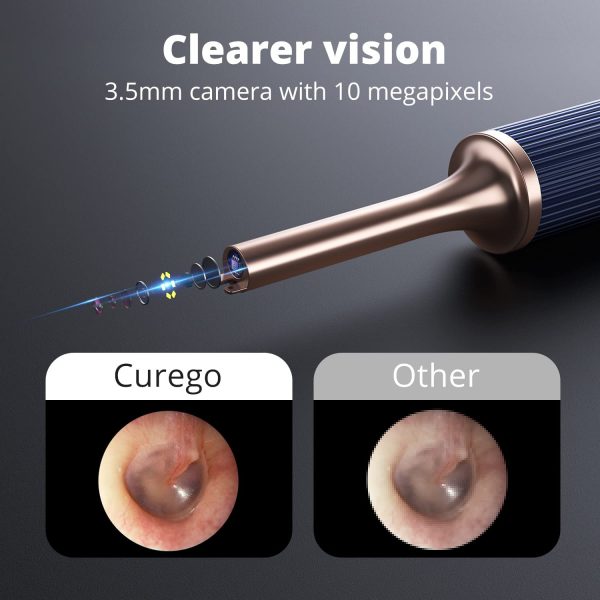 Curego Note3 Ear Wax Removal Tweezers & Cleaner 10MP HD Camera for iPhone,iPad, Android Phones