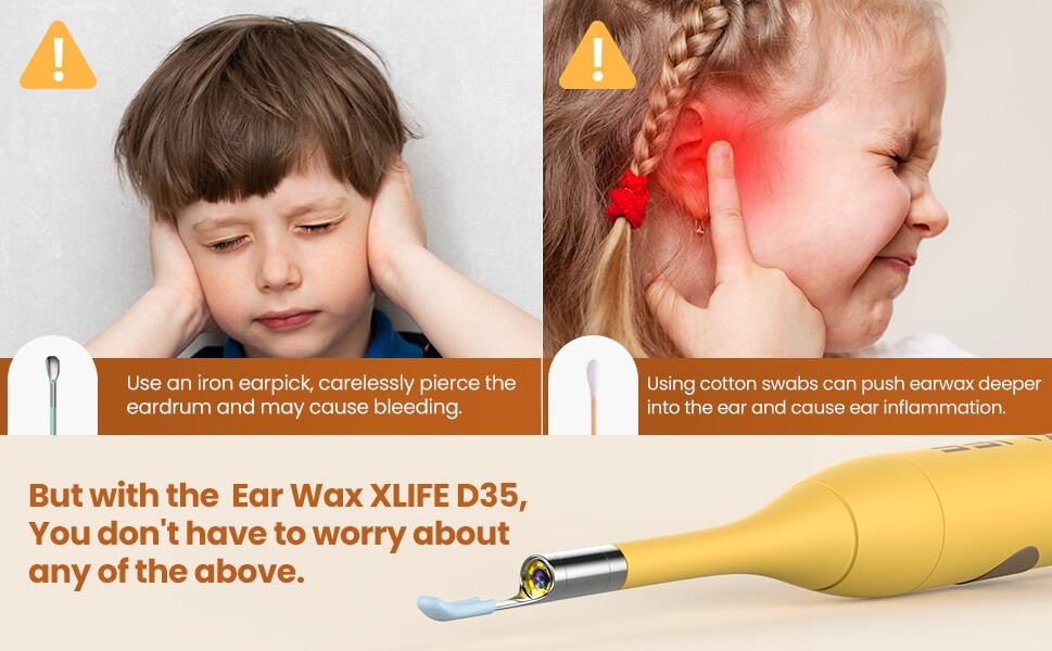 Bebird Most Cost-effective Model Xlife X3 APP Visual Ear Scooper Earpicks  Ear Cleaner,Earwax Removal Kits For Adults or Kids